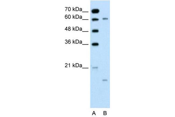 CYP4A22 anticorps  (N-Term)