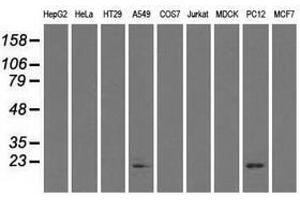 Image no. 2 for anti-Crystallin, alpha B (CRYAB) antibody (ABIN1497644) (CRYAB anticorps)