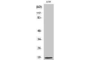 Western Blotting (WB) image for anti-Stathmin 1 (STMN1) (Ser732) antibody (ABIN3176674) (Stathmin 1 anticorps  (Ser732))