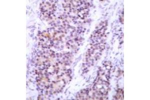 Image no. 2 for anti-BCL2-Like 1 (BCL2L1) (pSer62) antibody (ABIN317973) (BCL2L1 anticorps  (pSer62))