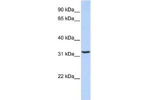 WB Suggested Anti-JMJD8 Antibody Titration: 0. (JMJD8 anticorps  (Middle Region))