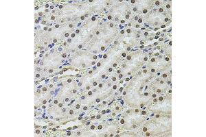 Immunohistochemistry of paraffin-embedded rat kidney using SET/T antibody (ABIN6131351, ABIN6147629, ABIN6147632 and ABIN6216153) at dilution of 1:100 (40x lens). (SET/TAF-I anticorps  (AA 146-277))