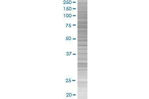 SP110 transfected lysate. (SP110 293T Cell Transient Overexpression Lysate(Denatured))