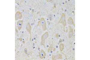 Immunohistochemistry of paraffin-embedded mouse brain using EPHA2 Antibody (ABIN5975494) at dilution of 1/100 (40x lens). (EPH Receptor A2 anticorps)