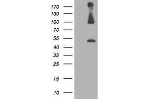 Western Blotting (WB) image for anti-Proteasome (Prosome, Macropain) 26S Subunit, Non-ATPase, 2 (PSMD2) antibody (ABIN1500483) (PSMD2 anticorps)