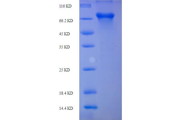 PLBD2 Protein (AA 36-585) (His-SUMO Tag)