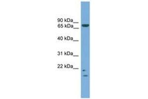 Image no. 1 for anti-MRE11 Meiotic Recombination 11 Homolog A (S. Cerevisiae) (MRE11A) (AA 35-84) antibody (ABIN6745121) (Mre11 anticorps  (AA 35-84))