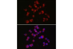 Immunofluorescence analysis of Neuro-2a cells using DCX Rabbit pAb (ABIN7266839) at dilution of 1:150 (40x lens). (Doublecortin anticorps  (AA 240-360))