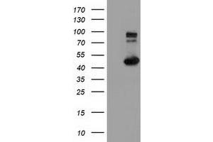 Western Blotting (WB) image for anti-Intraflagellar Transport 57 Homolog (IFT57) antibody (ABIN1498810) (IFT57 anticorps)