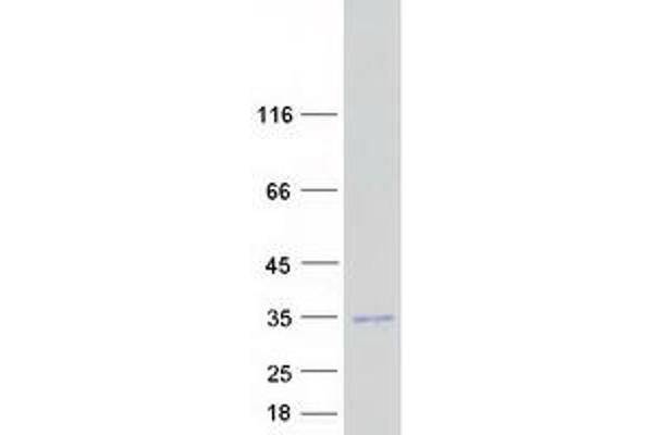 CHCHD6 Protein (Myc-DYKDDDDK Tag)