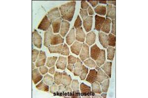 STX7 Antibody immunohistochemistry analysis in formalin fixed and paraffin embedded human skeletal muscle followed by peroxidase conjugation of the secondary antibody and DAB staining. (Syntaxin 7 anticorps  (N-Term))