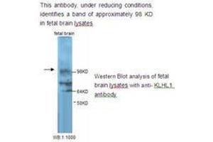 Image no. 1 for anti-Kelch-Like 1 (KLHL1) antibody (ABIN790846) (KLHL1 anticorps)