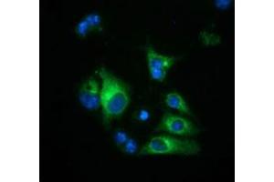 Anti-HP mouse monoclonal antibody (ABIN2453137) immunofluorescent staining of COS7 cells transiently transfected by pCMV6-ENTRY HP (RC223612). (Haptoglobin anticorps)