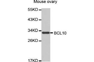 Western Blotting (WB) image for anti-B-Cell CLL/lymphoma 10 (BCL10) antibody (ABIN1678837) (BCL10 anticorps)