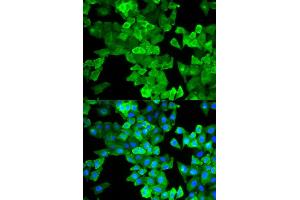 Immunofluorescence (IF) image for anti-Caldesmon 1 (CALD1) antibody (ABIN1876554) (Caldesmon anticorps)