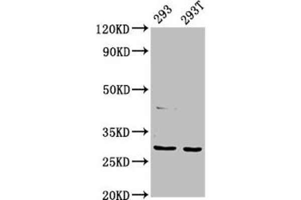 AANAT anticorps  (AA 1-207)