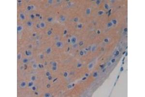 Used in DAB staining on fromalin fixed paraffin- embedded brain tissue (CHRDL1 anticorps  (AA 272-447))