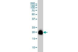 RHOA monoclonal antibody (M08), clone 1C3 Western Blot analysis of RHOA expression in A-431 . (RHOA anticorps  (AA 1-193))