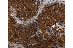 Immunohistochemistry (IHC) image for anti-LAG1 Homolog, Ceramide Synthase 5 (LASS5) antibody (ABIN2434918) (LASS5 anticorps)