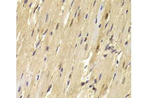 Immunohistochemistry of paraffin-embedded Mouse heart using TOPBP1 Polyclonal Antibody at dilution of 1:100 (40x lens). (TOPBP1 anticorps)