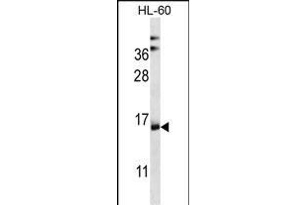 NDUFAF4 anticorps  (N-Term)