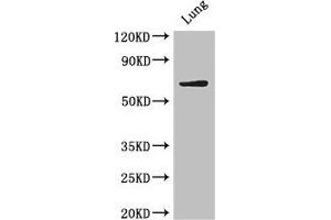 Western Blot Positive WB detected in: Mouse lung tissue All lanes: BIRC3 antibody at 4 μg/mL Secondary Goat polyclonal to rabbit IgG at 1/50000 dilution Predicted band size: 69 kDa Observed band size: 69 kDa (BIRC3 anticorps  (AA 76-245))