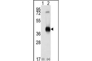 Western blot analysis of CK1 (arrow) using rabbit polyclonal CK1 Antibody (C-term) (ABIN391310 and ABIN2841344). (CAMK1 anticorps  (C-Term))