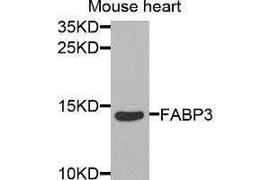 Western blot analysis of extracts of mouse heart, using FABP3 antibody (ABIN5973057) at 1/1000 dilution. (FABP3 anticorps)
