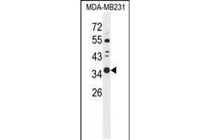 Western blot analysis of STX7 Antibody in MDA-MB231 cell line lysates (35ug/lane) (Syntaxin 7 anticorps  (N-Term))