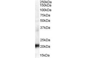 Western Blotting (WB) image for anti-Coiled-Coil Domain Containing 176 (CCDC176) (N-Term) antibody (ABIN2156539) (C14orf45 anticorps  (N-Term))