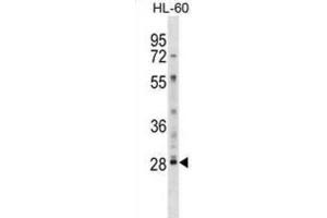 Western Blotting (WB) image for anti-Lymphocyte Antigen 6 Complex, Locus G6F (LY6G6F) antibody (ABIN2999007) (LY6G6F anticorps)