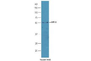 Western Blotting (WB) image for anti-Mitogen-Activated Protein Kinase Kinase 5 (MAP2K5) (AA 251-350) antibody (ABIN754183)