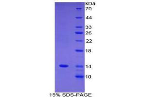 SDS-PAGE (SDS) image for Family with Sequence Similarity 19 (Chemokine (C-C Motif)-Like), Member A3 (FAM19A3) (AA 44-130) protein (His tag) (ABIN1880053) (FAM19A3 Protein (AA 44-130) (His tag))