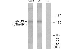 Western blot analysis of extracts from Jurkat cells and HepG2 cells, using eNOS (Phospho-Thr494) antibody. (ENOS anticorps  (pThr494))
