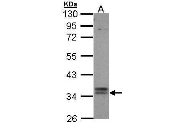 GPBAR1 anticorps  (C-Term)