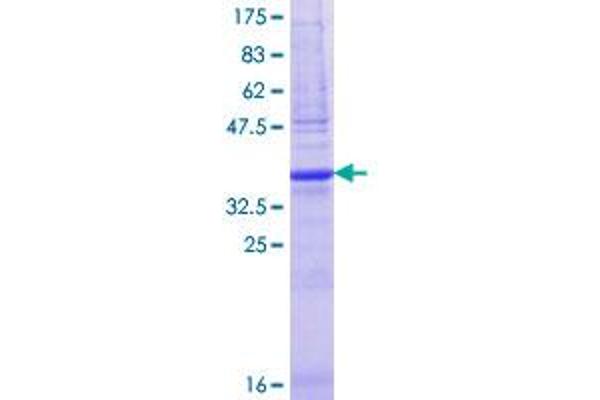 G Antigen 5 Protein (GAGE5) (AA 28-117) (GST tag)