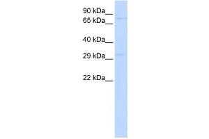 Western Blotting (WB) image for anti-Paired-Like Homeobox 2a (PHOX2A) antibody (ABIN2457912) (PHOX2A anticorps)