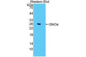 Western blot analysis of the recombinant protein. (POMT1 anticorps  (AA 318-513))