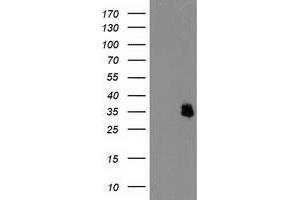 HEK293T cells were transfected with the pCMV6-ENTRY control (Left lane) or pCMV6-ENTRY IFI35 (Right lane) cDNA for 48 hrs and lysed. (IFI35 anticorps)