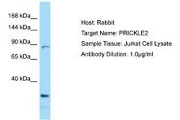 PRICKLE2 anticorps  (C-Term)