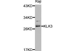 Western blot analysis of extracts of raji cells, using KLK3 antibody. (Prostate Specific Antigen anticorps)