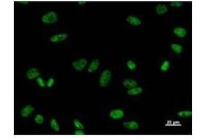 Immunostaining analysis in HeLa cells. (PRPF8 anticorps)