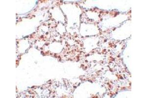 Immunohistochemistry of ZSCAN4 in rat lung tissue with this product at 5 μg/ml. (ZSCAN4 anticorps  (C-Term))