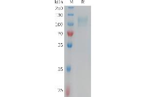 Human CD62E Protein, His Tag on SDS-PAGE under reducing condition. (Selectin E/CD62e Protein (AA 22-556) (His tag))