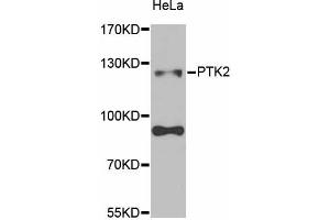 Western blot analysis of extracts of HeLa cells, using PTK2 antibody (ABIN5971141) at 1/1000 dilution. (FAK anticorps)