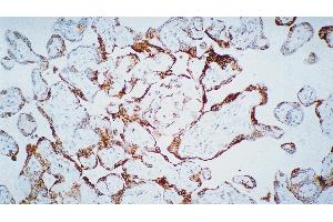 Human placenta: immunohistochemical staining for Vascular Endothelial Growth Factor Receptor-3: clone KLT9 (FLT4 anticorps)