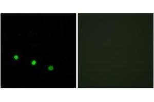 Immunofluorescence analysis of HuvEc cells treated with EGF 200nM 5', using FosB (Phospho-Ser27) Antibody. (FOSB anticorps  (pSer27))