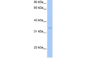 PDXK antibody used at 1 ug/ml to detect target protein. (PDXK anticorps)