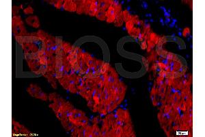 Formalin-fixed and paraffin embedded rat heart tissue labeled with Rabbit Anti-DOG-1/TMEM16A Polyclonal Antibody, Unconjugated (ABIN704216) at 1:200 followed by conjugation to the secondary antibody and DAB staining. (ANO1 anticorps  (AA 151-250))