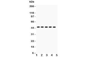 Western blot testing of PIM-1 antibody and human samples 1:  U20S;  2: A549;  3: COLO320;  4: SW620;  5: Jurkat. (PIM1 anticorps  (C-Term))